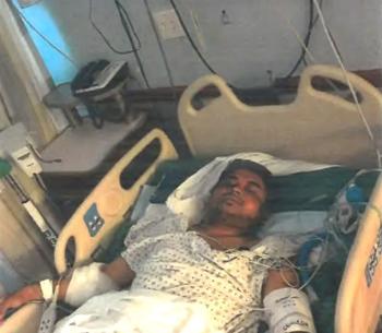 New York Man Awarded Nearly $23 Million After Losing Toes in Subway Accident