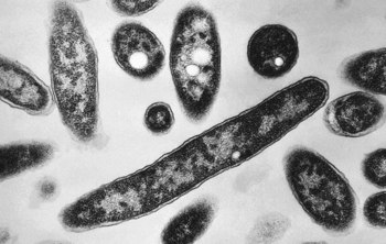 Legionnaires Outbreak in New York Traced to City Buildings Including Harlem Hospital