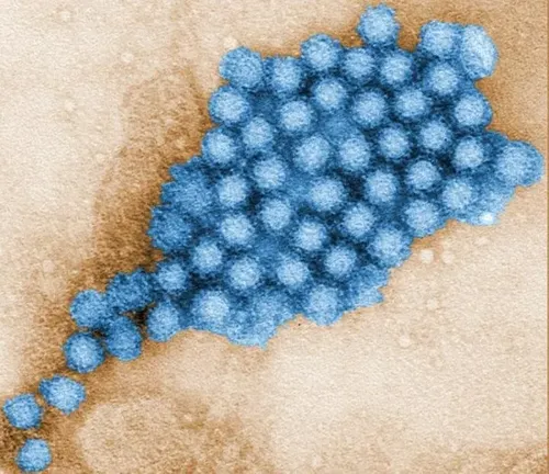 Norovirus Cases Rising in Illinois and Midwest Ahead of Holidays