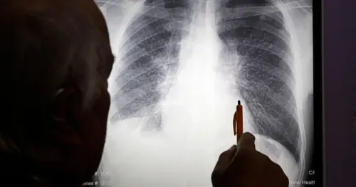 Engineered Stone's Hidden Toll: Young Workers Are Dying From Silicosis as Industry Fights Accountability