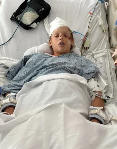 12-Year-Old Hospitalized with Life-Threatening Injuries After E-Bike Collision in San Diego