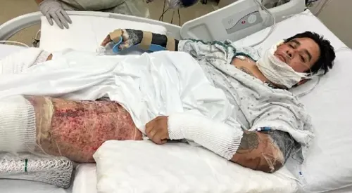 San Antonio Man Hospitalized After Attempting to Break Up Fight