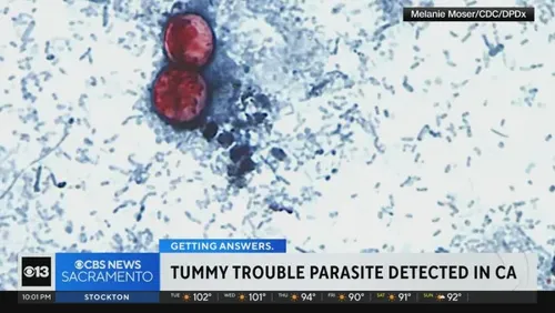 Surge in Cyclosporiasis Cases Reported in California Amid Multi-State Outbreak